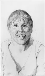 Cretin, Front View, Illustration from an Unpublished Treatise by Jean Etienne Dominique Esquirol on the Lunatics of the Salpetriere Asylum, c.1818